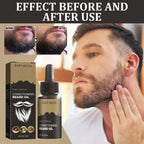 30ml Facial Hair Beard Growth Oil Serum For Men's Thick Soft Smooth Beard Oil Natural Moisturizing Beard Grooming Oil Beard Care